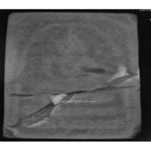 พระสมเด็จบางขุนพรหม พิมพ์อกครุฑ