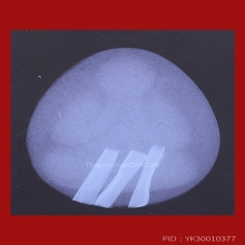 *** 5 PIECES!!! IN THE WORLD!!! ***