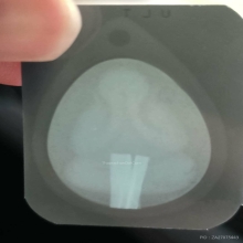 ปิดตามหาลาภหรือปิดตาหลังเต่าตะกรุด2ดอก